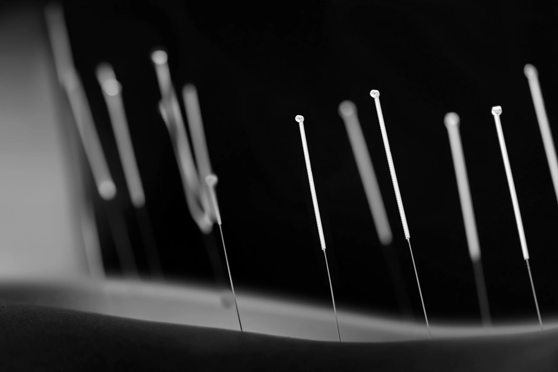 agujas de puncion seca